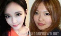 爆料小猪整容视频播放大全,视频播放大全大起底