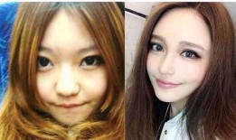 爆料小猪整容视频播放大全,视频播放大全大起底